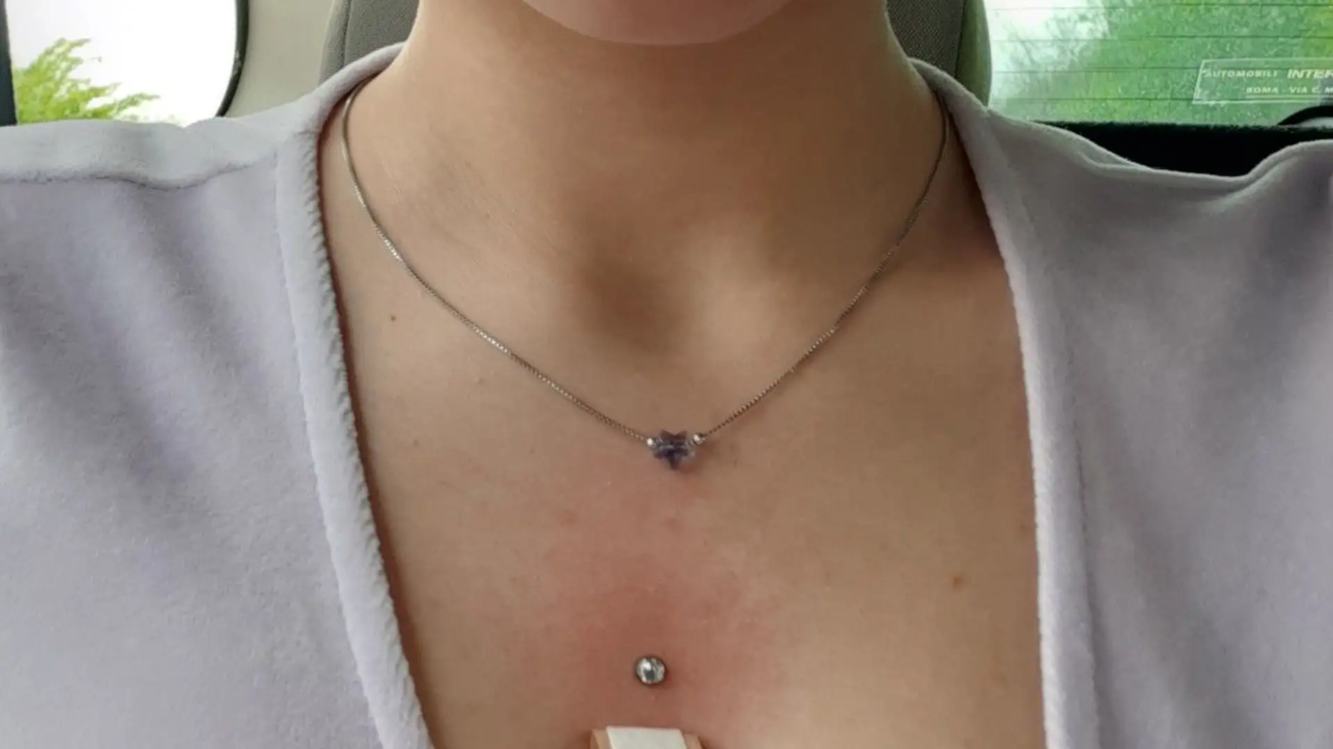 microdermal