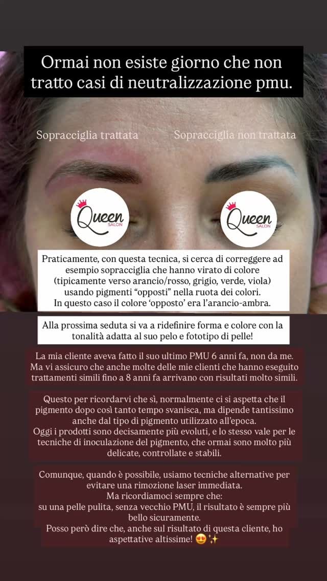 💌3200454875 su whatsapp oppure in DM per consulenze/informazioni, disponibilità e prenotazioni ✨

#correzionepmu
#neutralizzazionesopracciglia
#sopraccigliacorrette
#coperturapmu
#rimuovemicroblading
#viraggiopigmento
#sopraccigliasbiadite
#microblading
#pigmanetazionelabbda
#pmuavanzato