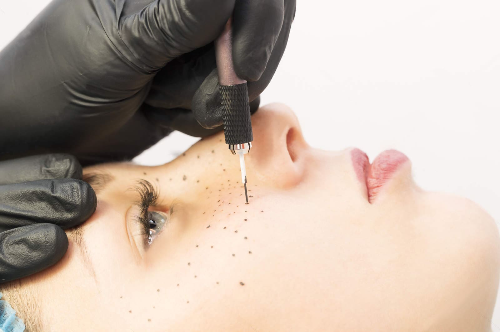 queen salon -freckling-lentig