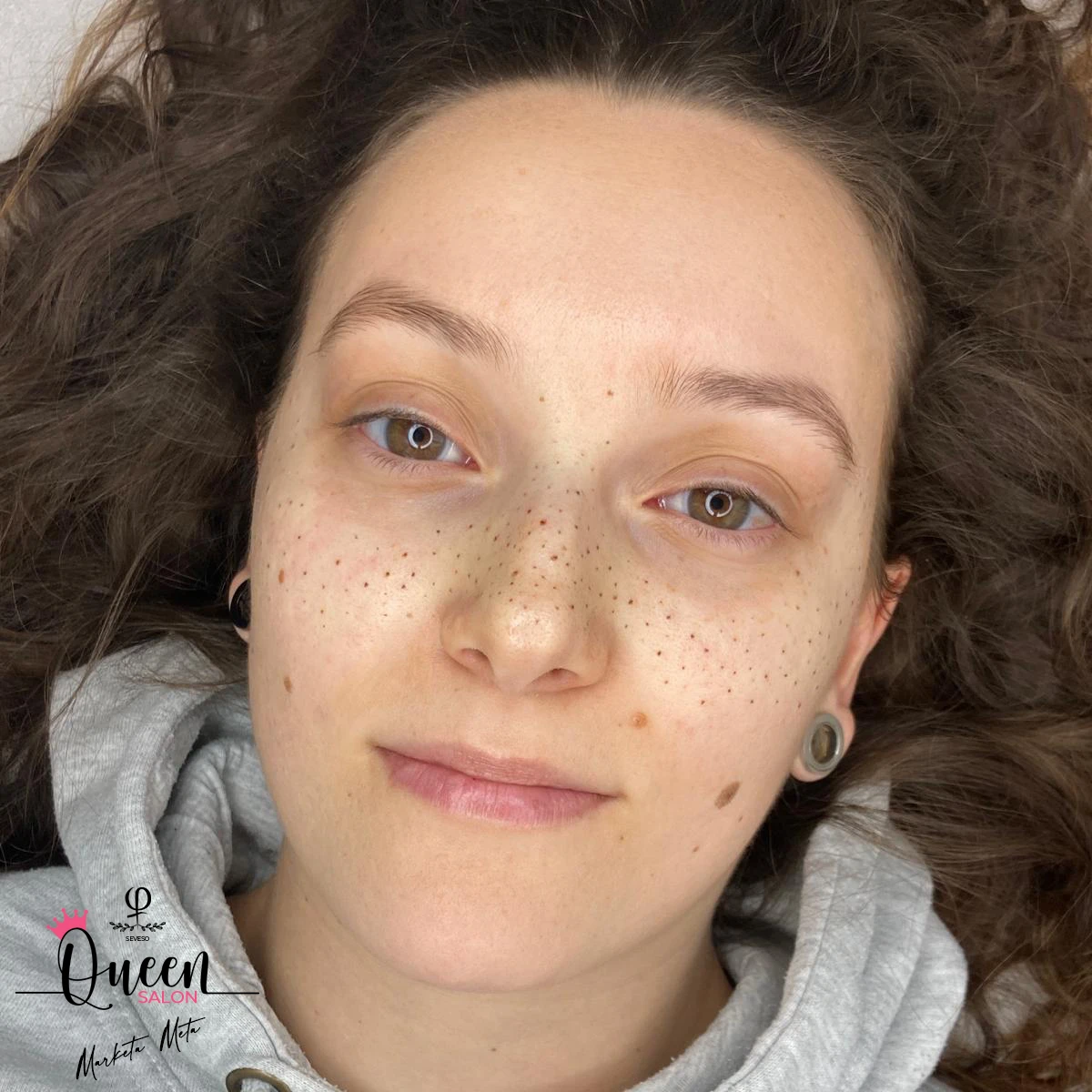 Lentiggini PMU | Queen Salon - Seveso