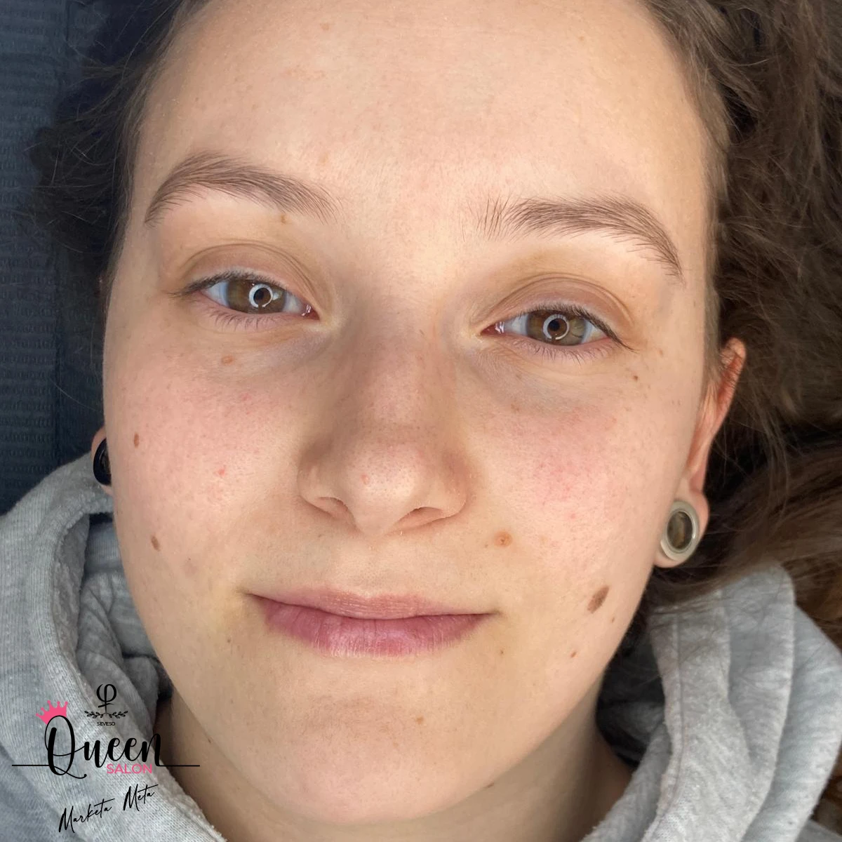 Lentiggini PMU | Queen Salon - Seveso