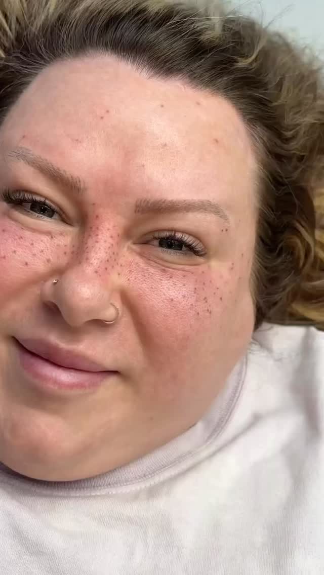 Lentiggini tatuate sulla dolcissima @lilyhymes 🌸 
+extension ciglia 1:1 fatte giorni fa ✨

Per info, consulenze e prenotazioni scrivici in DM o su WhatsApp al 3200454875 💌

#tattoo #piercing #cigliaseveso #finelineseveso #lentiggini