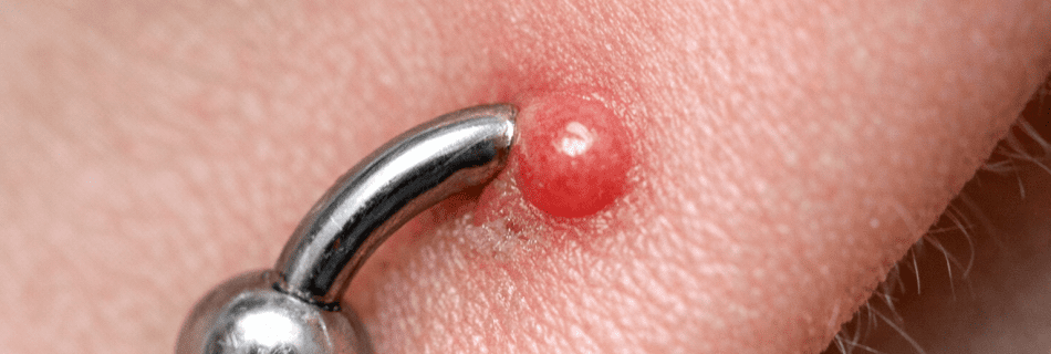 Bollicina accanto al piercing durante la fase di guarigione