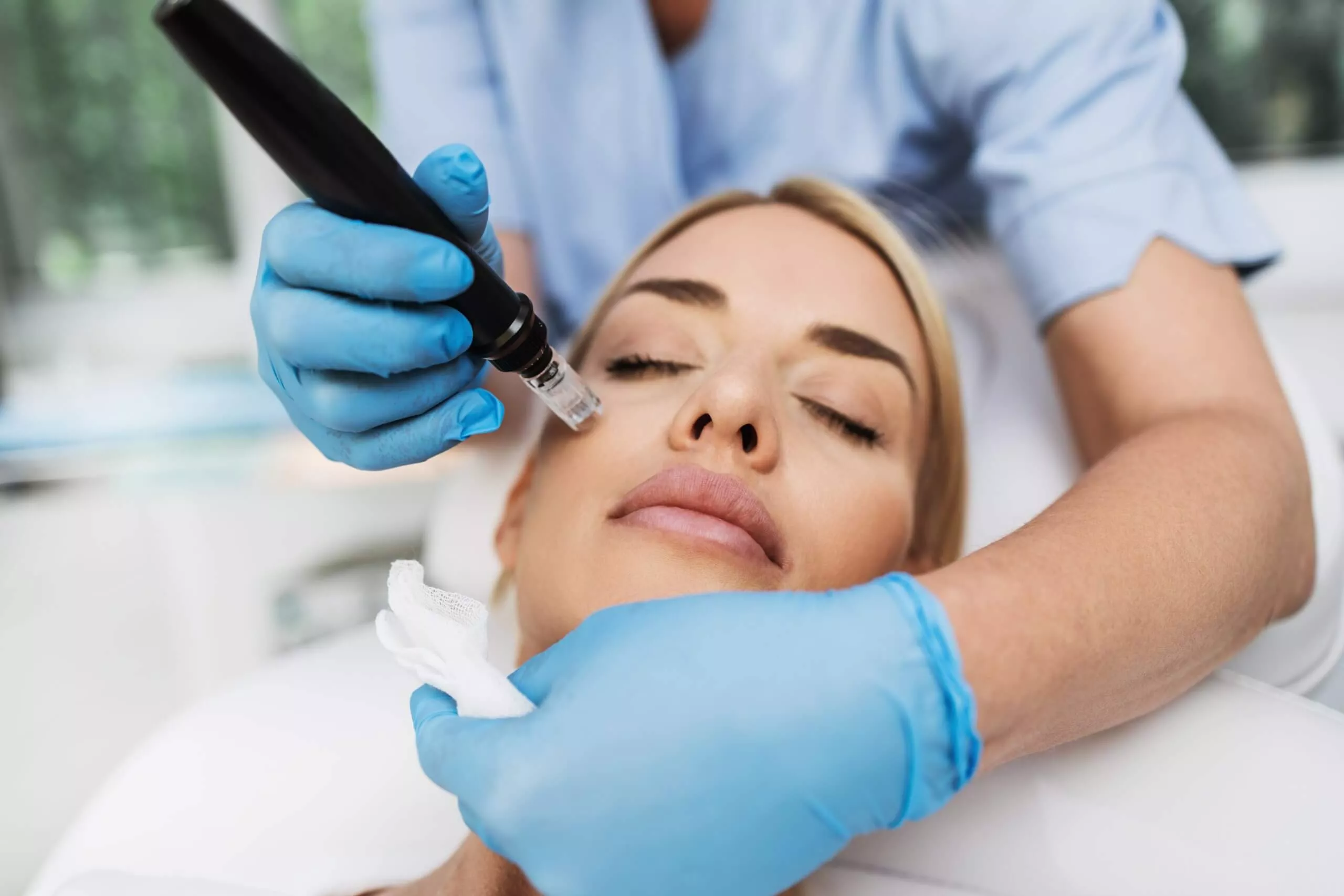 Guida Microneedling: tecnica professionale con dermografo