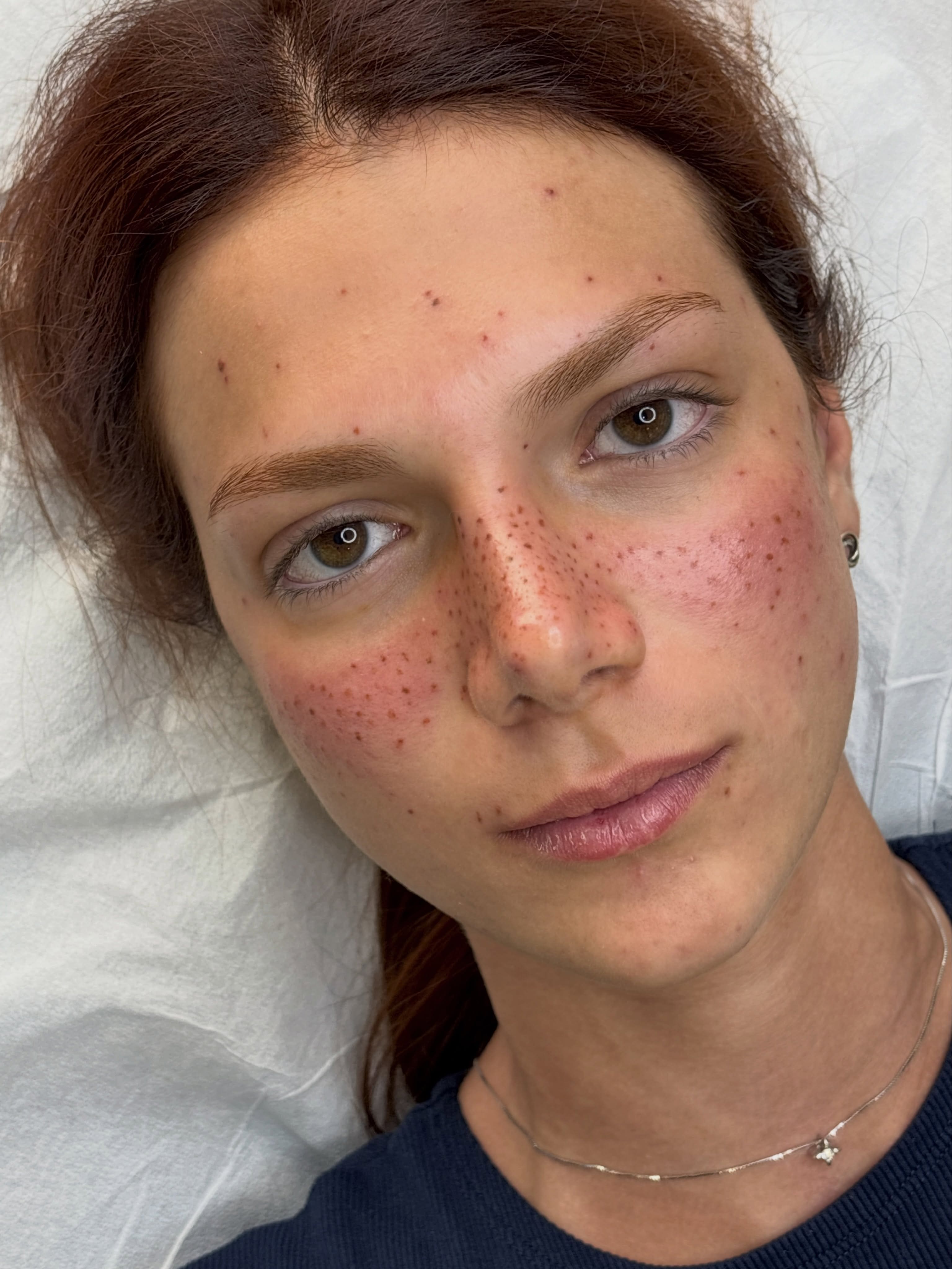 Le vedi così… ma aspetta la guarigione 🤩

Le lentiggini appena tatuate sono sempre più intense: nei prossimi giorni il colore si ammorbidirà, si schiarirà e diventeranno ancora più naturali. Anche il rossore sulle guance è normalissimo e scompare nel giro di poche ore.

Il risultato? Quel fascino fresco, spontaneo e come se fossero sempre state lì 🤎

📲 320 045 4875
📍 Seveso (MB), Corso Federico Borromeo 28
#lentiggini #tattoolentigginimilano #lentigginimonza #lentigginimilano #lentigginitatuate